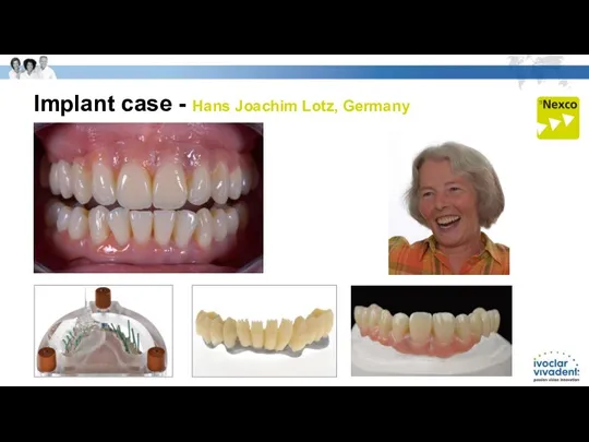 Implant case - Hans Joachim Lotz, Germany