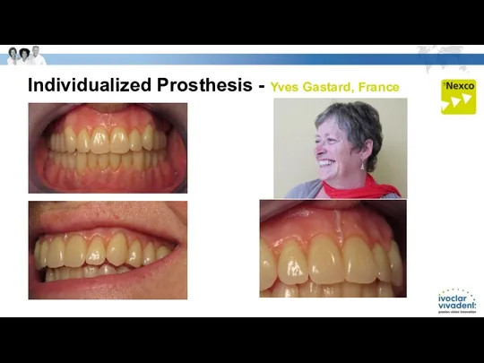 Individualized Prosthesis - Yves Gastard, France