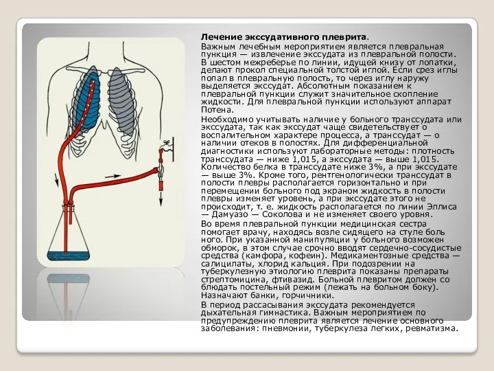 Лечение экссудативного плеврита. Важным лечебным мероприятием является плевральная пункция —