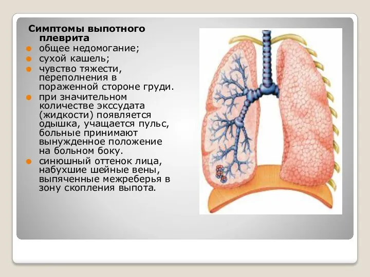 Симптомы выпотного плеврита общее недомогание; сухой кашель; чувство тяжести, переполнения