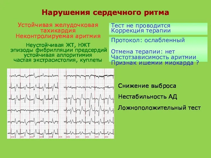 Нарушения сердечного ритма Устойчивая желудочковая тахикардия Неконтролируемая аритмия Неустойчивая ЖТ,