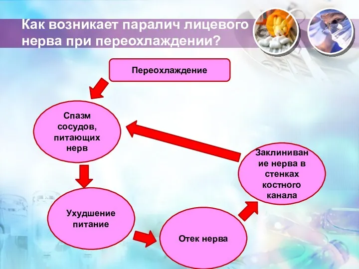 Как возникает паралич лицевого нерва при переохлаждении? Переохлаждение Спазм сосудов,