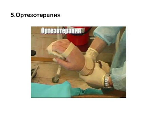 5.Ортезотерапия