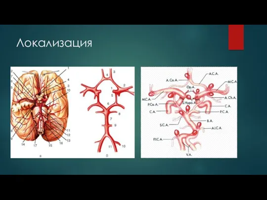 Локализация