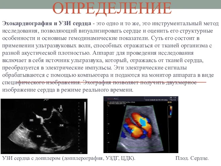 ОПРЕДЕЛЕНИЕ Эхокардиография и УЗИ сердца - это одно и то