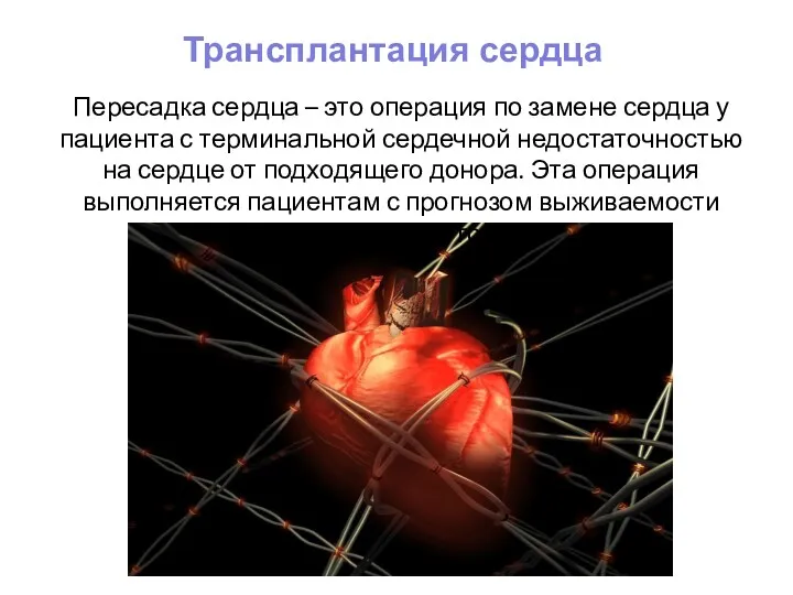 Пересадка сердца – это операция по замене сердца у пациента