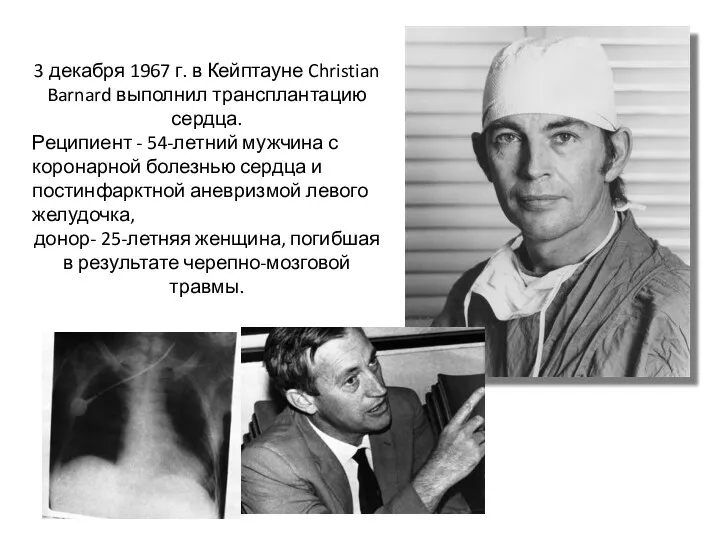 3 декабря 1967 г. в Кейптауне Christian Barnard выполнил трансплантацию