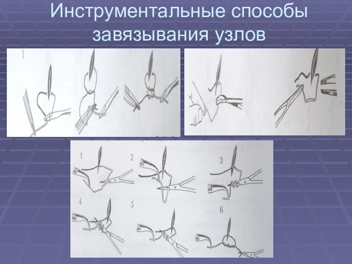 Инструментальные способы завязывания узлов