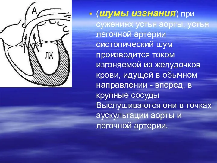 (шумы изгнания) при сужениях устья аорты, устья легочной артерии систолический