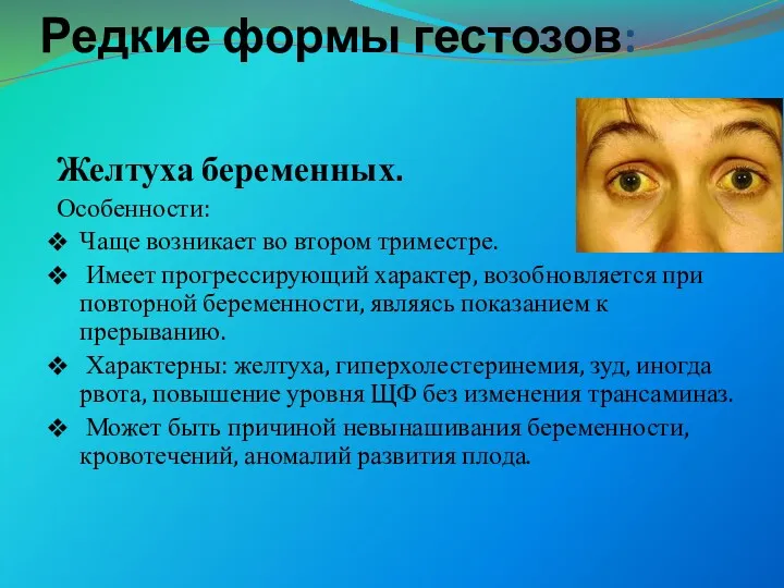 Редкие формы гестозов: Желтуха беременных. Особенности: Чаще возникает во втором