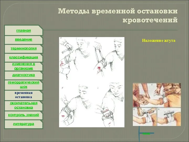 литература контроль знаний окончательная остановка временная остановка геморрагический шок диагностика