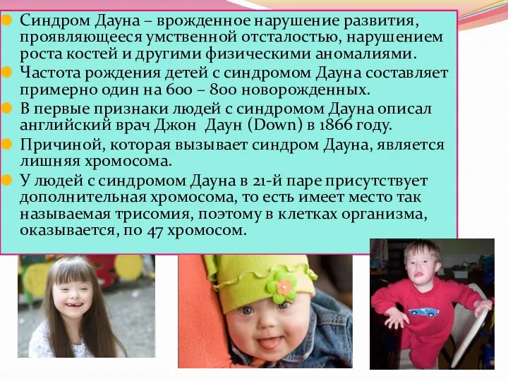 Синдром Дауна – врожденное нарушение развития, проявляющееся умственной отсталостью, нарушением