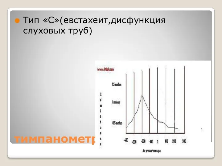 тимпанометрия Тип «С»(евстахеит,дисфункция слуховых труб)