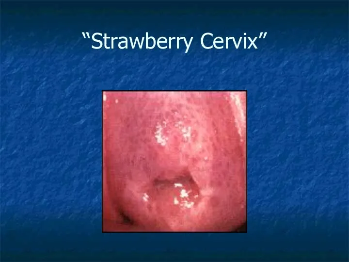 “Strawberry Cervix”