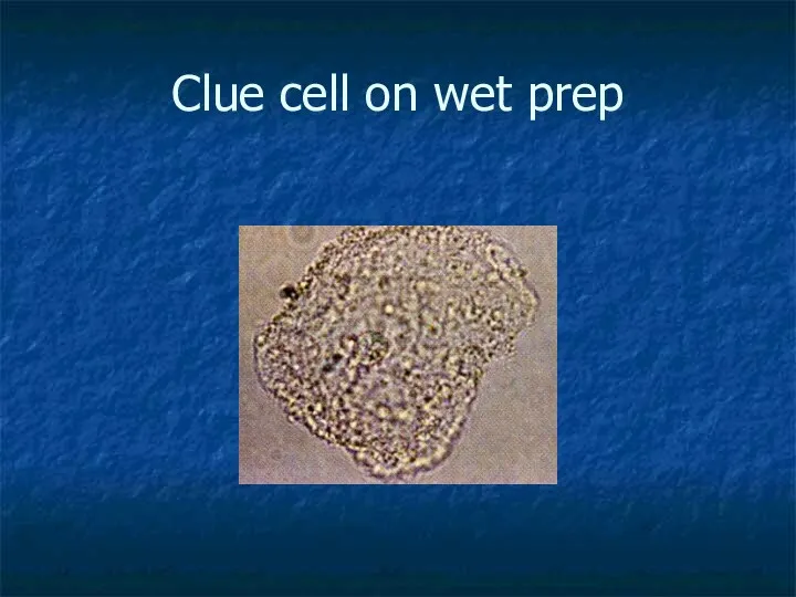 Clue cell on wet prep