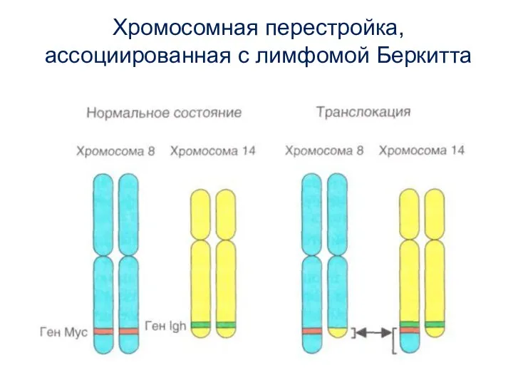 Хромосомная перестройка, ассоциированная с лимфомой Беркитта