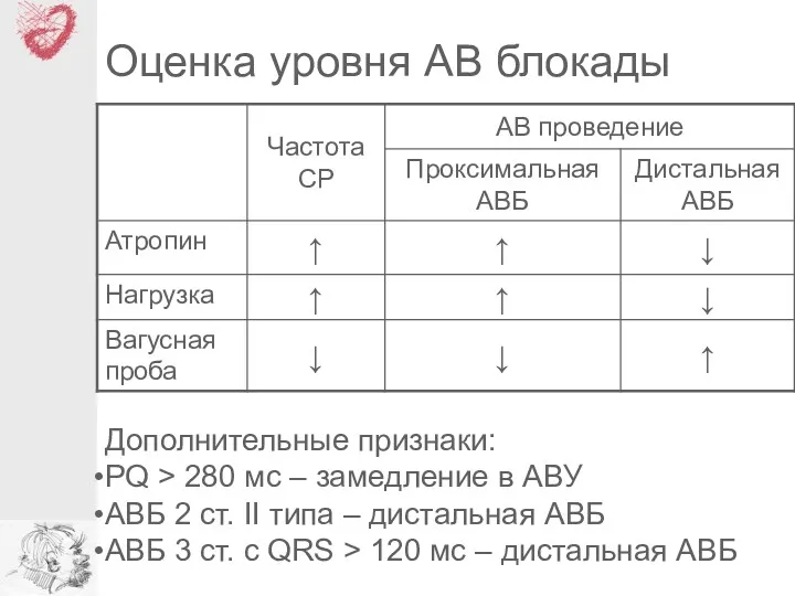 Оценка уровня АВ блокады Дополнительные признаки: PQ > 280 мс – замедление в