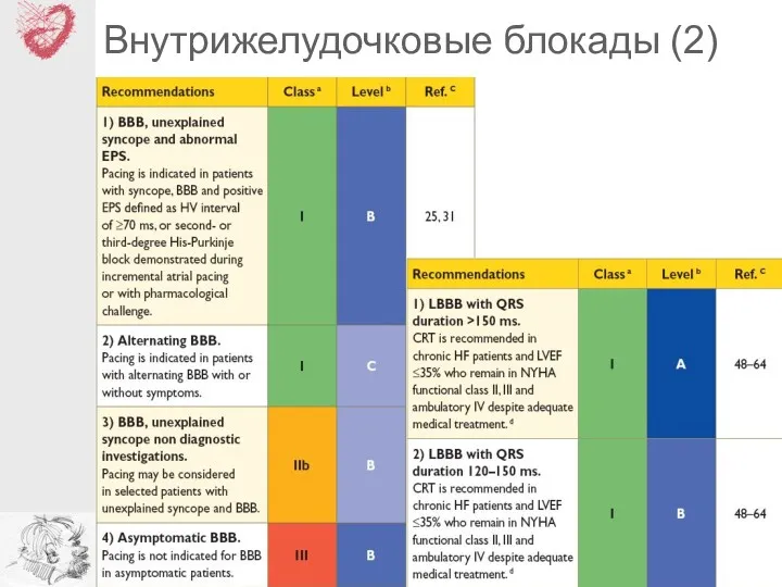 Внутрижелудочковые блокады (2)