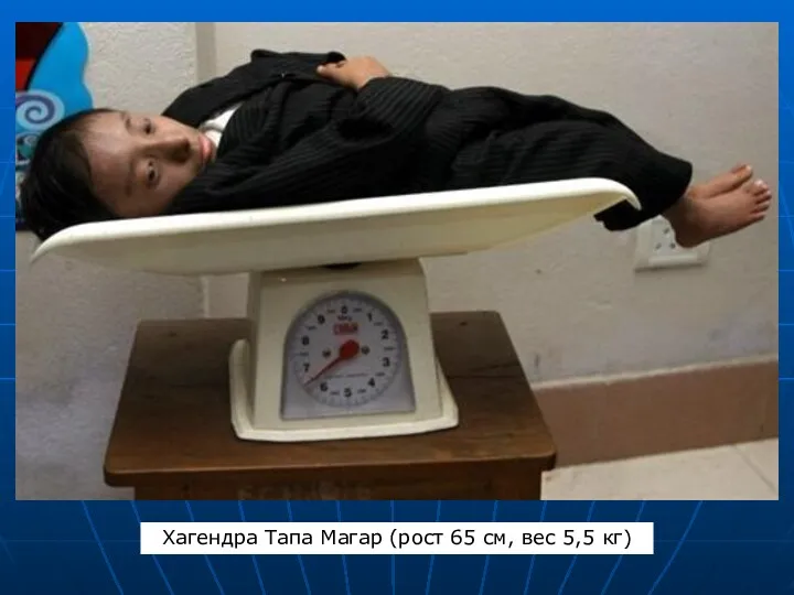 Хагендра Тапа Магар (рост 65 см, вес 5,5 кг)