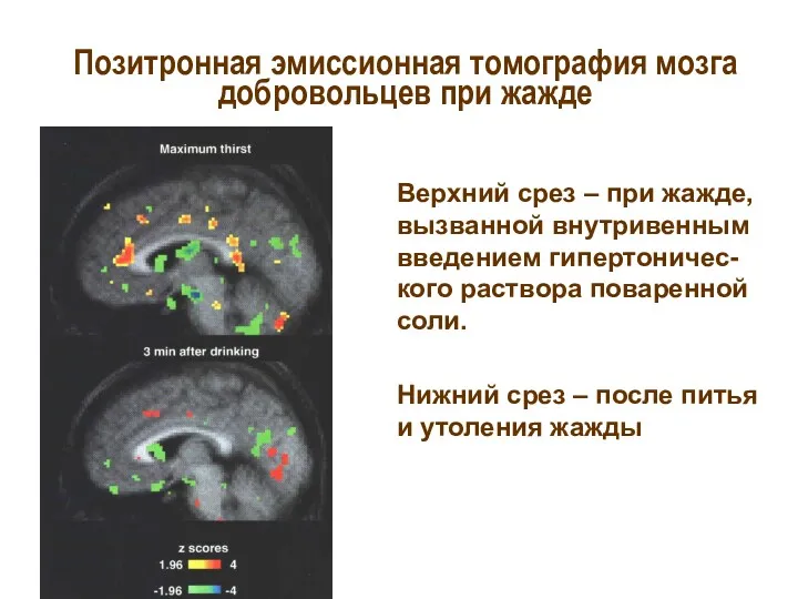 Позитронная эмиссионная томография мозга добровольцев при жажде Верхний срез –