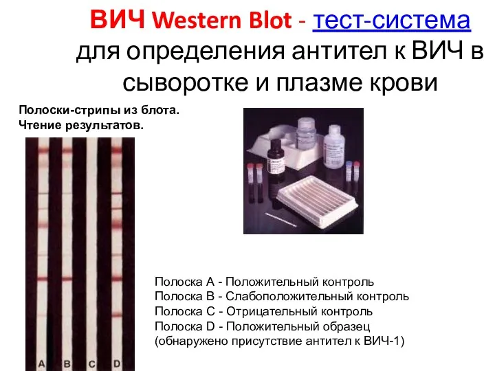 ВИЧ Western Blot - тест-система для определения антител к ВИЧ