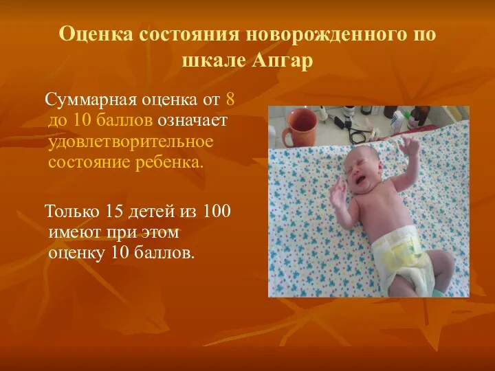 Оценка состояния новорожденного по шкале Апгар Суммарная оценка от 8