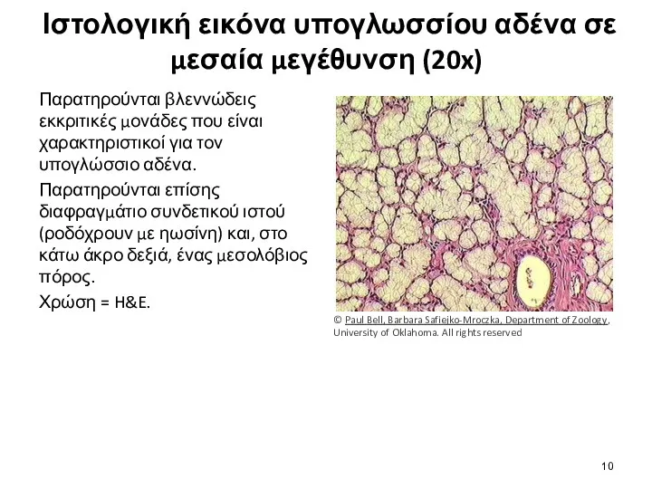 Ιστολογική εικόνα υπογλωσσίου αδένα σε μεσαία μεγέθυνση (20x) Παρατηρούνται βλεννώδεις