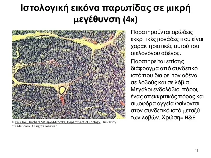 Ιστολογική εικόνα παρωτίδας σε μικρή μεγέθυνση (4x) Παρατηρούνται ορώδεις εκκριτικές