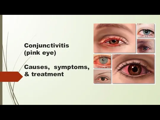 Conjunctivitis (pink eye) Causes, symptoms, &amp; treatment
