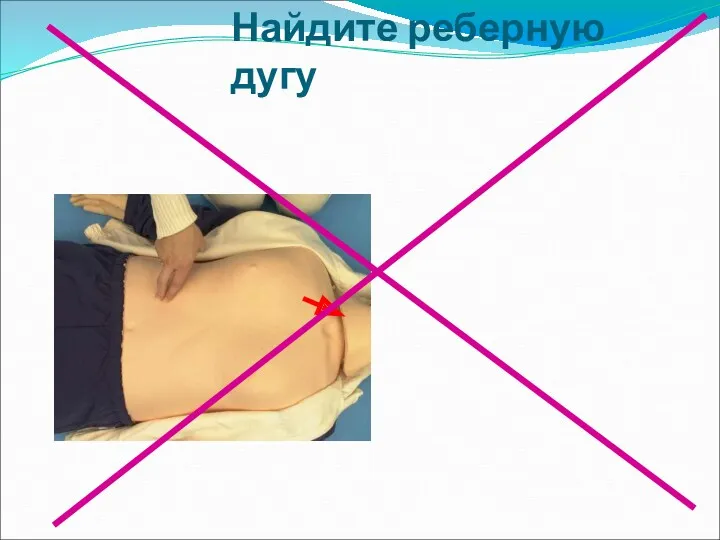 Найдите реберную дугу