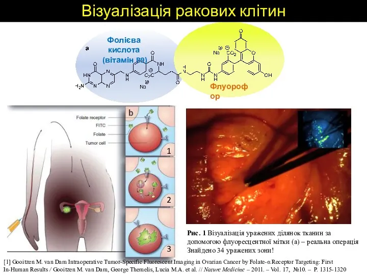 [1] Gooitzen M. van Dam Intraoperative Tumor-Specific Fluorescent Imaging in