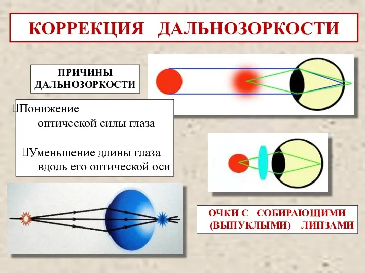 ОЧКИ С СОБИРАЮЩИМИ (ВЫПУКЛЫМИ) ЛИНЗАМИ КОРРЕКЦИЯ ДАЛЬНОЗОРКОСТИ ПРИЧИНЫ ДАЛЬНОЗОРКОСТИ Понижение