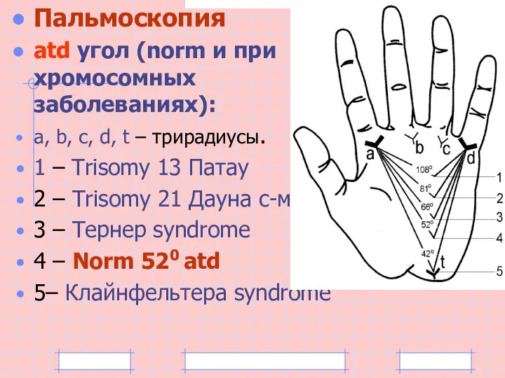 Пальмоскопия atd угол (norm и при хромосомных заболеваниях): a, b,