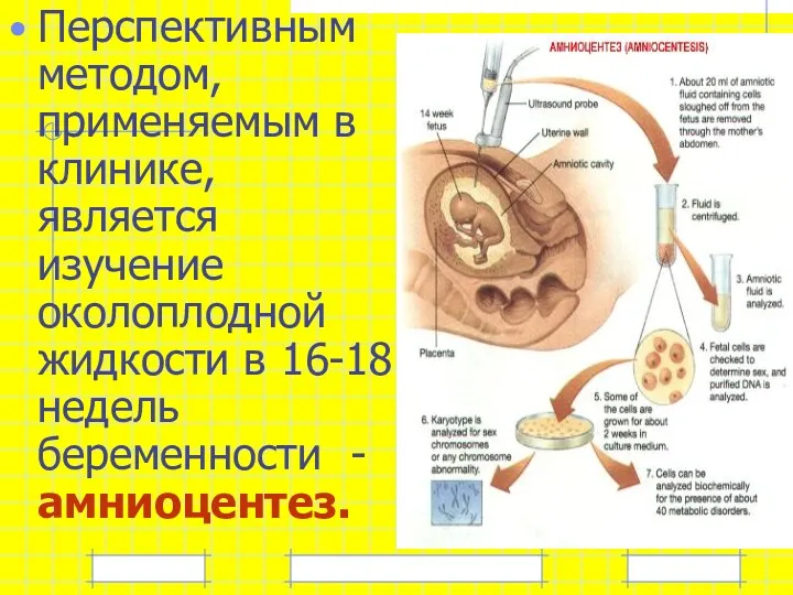 Перспективным методом, применяемым в клинике, является изучение околоплодной жидкости в 16-18 недель беременности - амниоцентез.