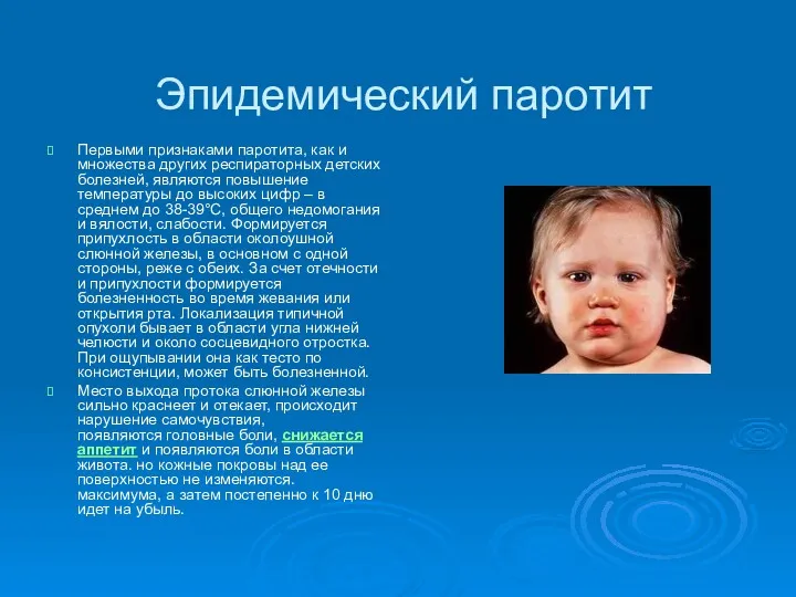 Эпидемический паротит Первыми признаками паротита, как и множества других респираторных