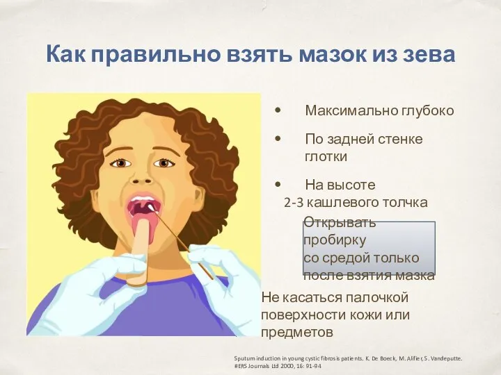 Как правильно взять мазок из зева Sputum induction in young cystic fibrosis patients.