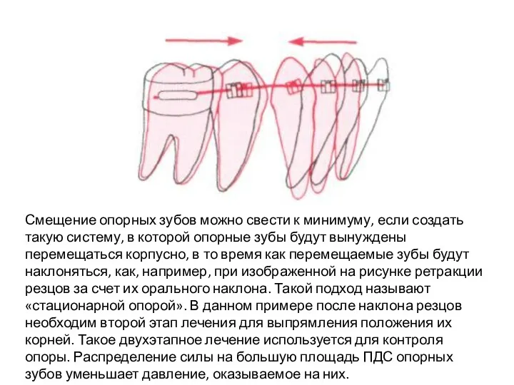 Смещение опорных зубов можно свести к минимуму, если создать такую