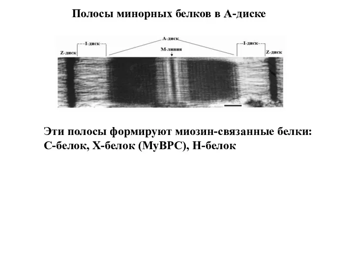 Полосы минорных белков в А-диске Эти полосы формируют миозин-связанные белки: С-белок, Х-белок (MyBPC), Н-белок