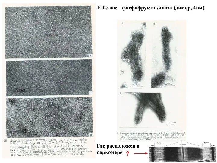 F-белок – фосфофруктокиназа (димер, 4нм) Где расположен в саркомере ?