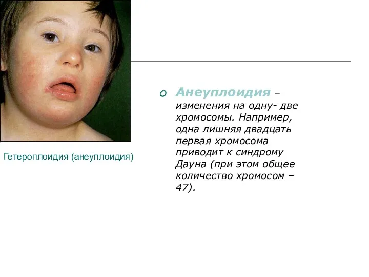 Гетероплоидия (анеуплоидия) Анеуплоидия – изменения на одну- две хромосомы. Например,