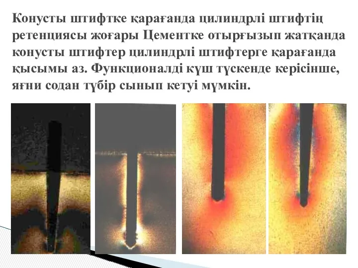 Конусты штифтке қарағанда цилиндрлі штифтің ретенциясы жоғары Цементке отырғызып жатқанда конусты штифтер цилиндрлі