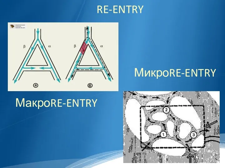 RE-ENTRY МакроRE-ENTRY МикроRE-ENTRY