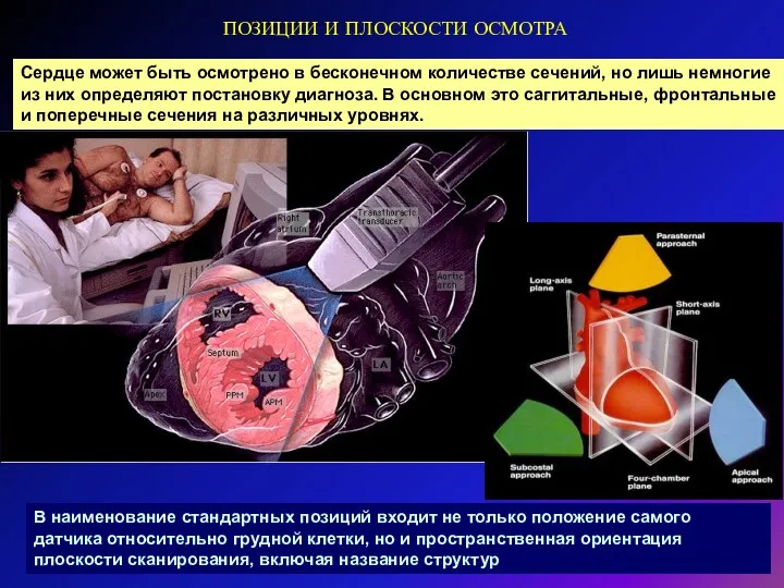 ПОЗИЦИИ И ПЛОСКОСТИ ОСМОТРА Сердце может быть осмотрено в бесконечном