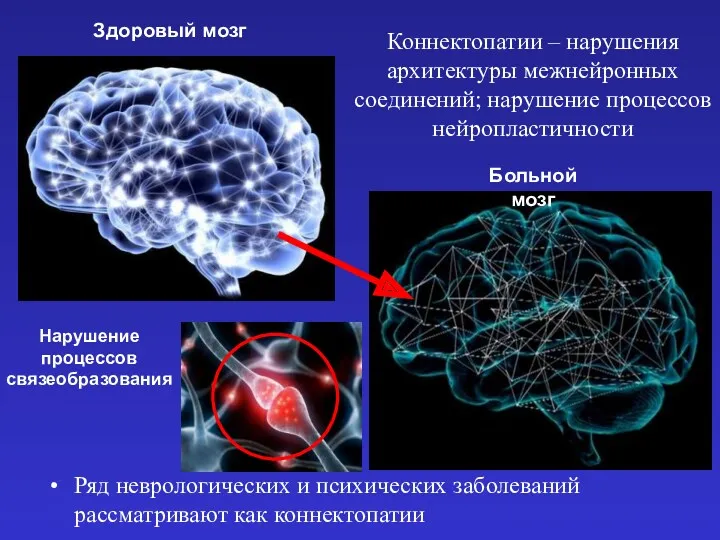 Коннектопатии – нарушения архитектуры межнейронных соединений; нарушение процессов нейропластичности Ряд