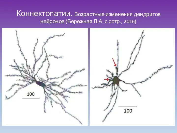 Коннектопатии. Возрастные изменения дендритов нейронов (Бережная Л.А. с сотр., 2016)