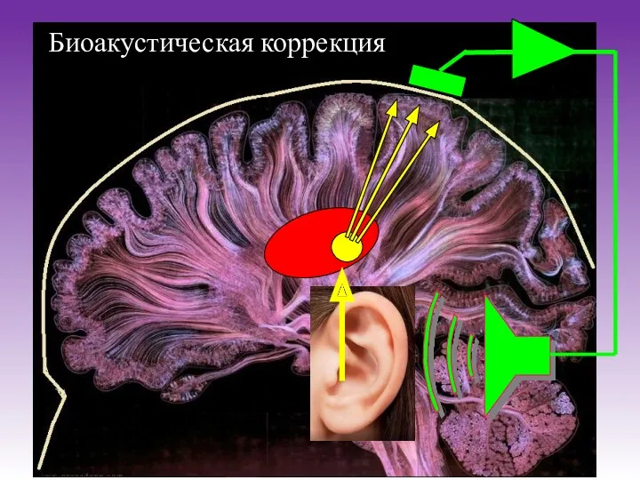 Биоакустическая коррекция