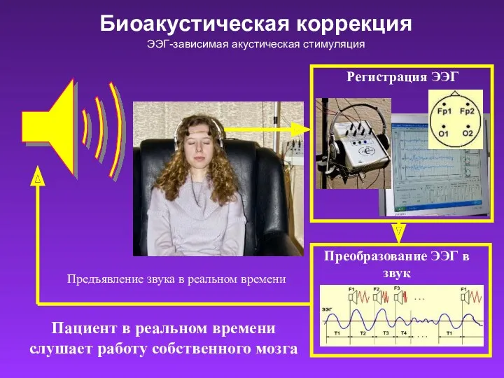 Пациент в реальном времени слушает работу собственного мозга Преобразование ЭЭГ