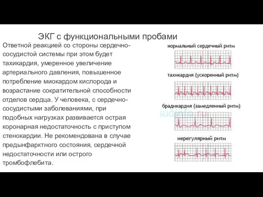 ЭКГ с функциональными пробами Ответной реакцией со стороны сердечно-сосудистой системы