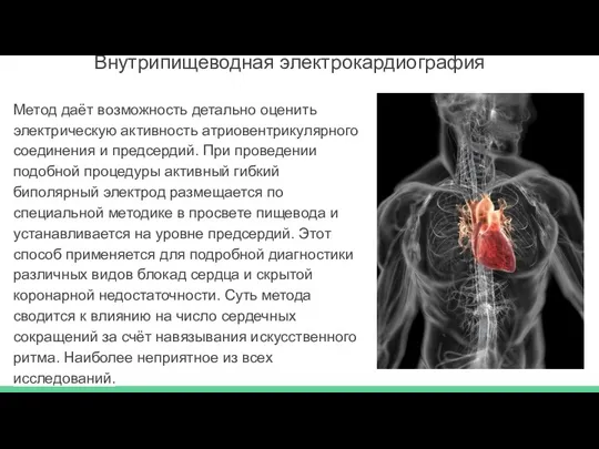 Внутрипищеводная электрокардиография Метод даёт возможность детально оценить электрическую активность атриовентрикулярного соединения и предсердий.