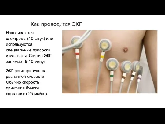 Как проводится ЭКГ Наклеиваются электроды (10 штук) или используются специальные